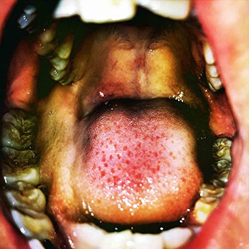 Public Storage by Hana Vu Album Cover