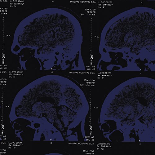 Mind Over Matter by The Nightingales